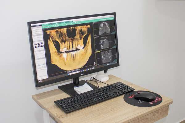 Dental Begastri - Radiodiagnóstico 3D