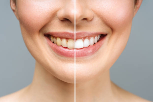 Dental Begastri - Estética Dental