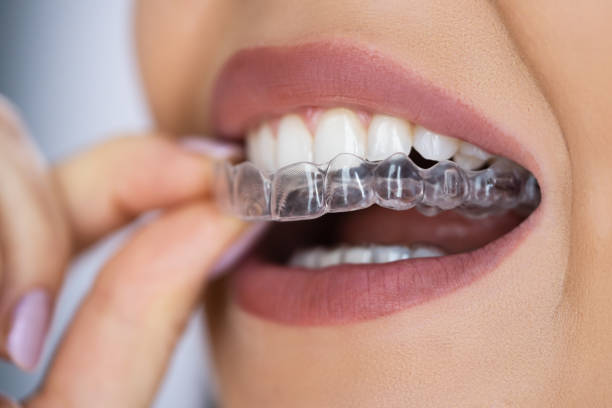 Dental Begastri - Ortodoncia